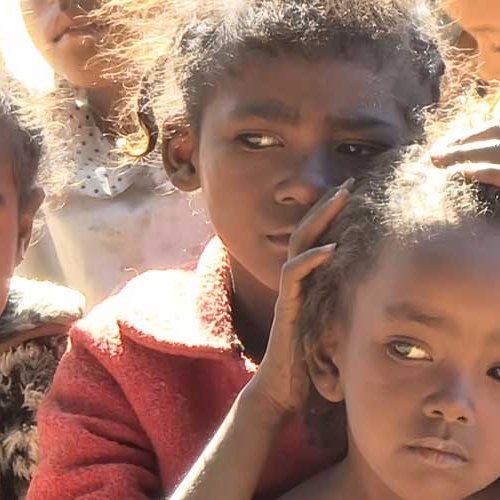 kinder-auf-madagaskar-leiden-unter-hunger